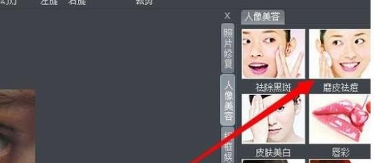 使用iSee图片专家为人像进行磨皮祛痘的详细方法_装机软件